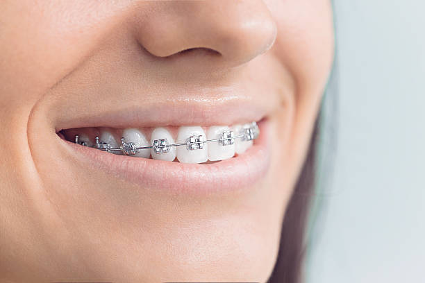 Best Teeth Whitening  in Bells, TX